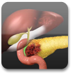 Hematología